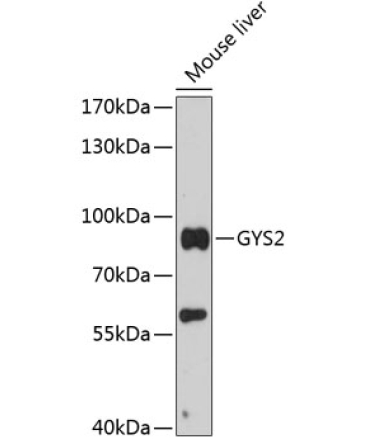 GYS2 Rabbit Polyclonal Antibody