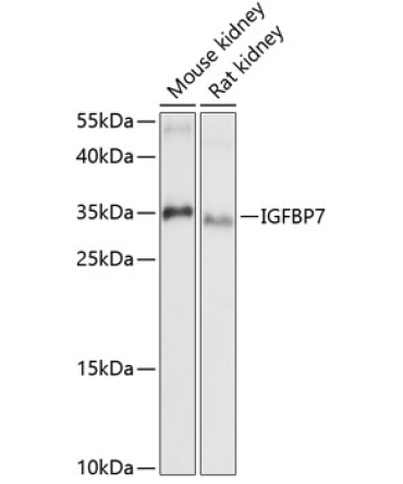 IGFBP7 Rabbit Polyclonal Antibody
