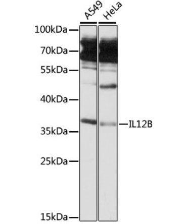IL12B Rabbit Polyclonal Antibody