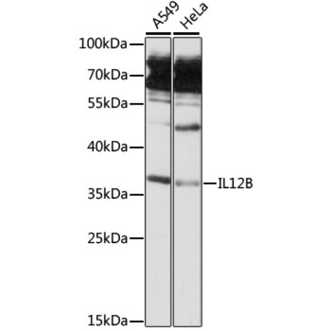 IL12B Rabbit Polyclonal Antibody