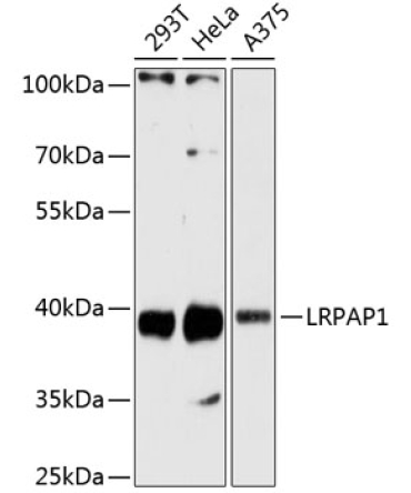 LRPAP1 Rabbit Polyclonal Antibody