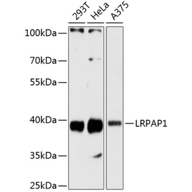 LRPAP1 Rabbit Polyclonal Antibody