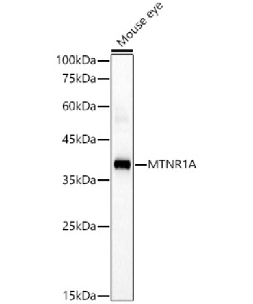 MTNR1A Rabbit Polyclonal Antibody