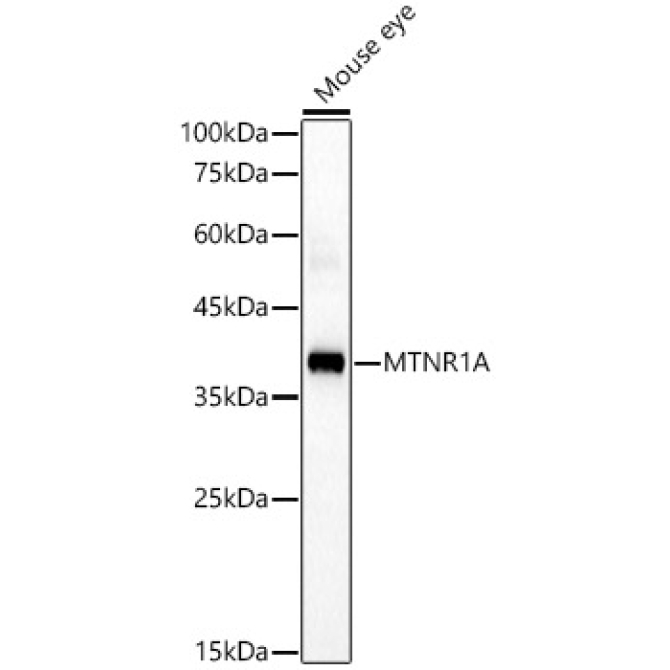 MTNR1A Rabbit Polyclonal Antibody