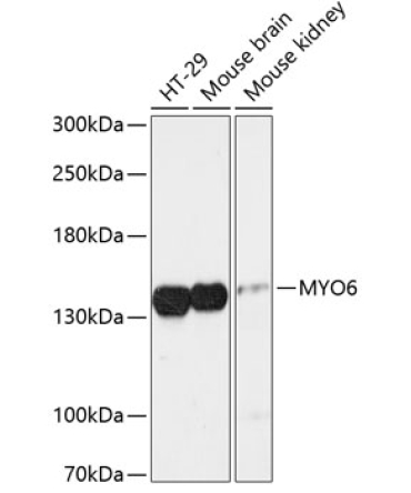 MYO6 Rabbit Polyclonal Antibody
