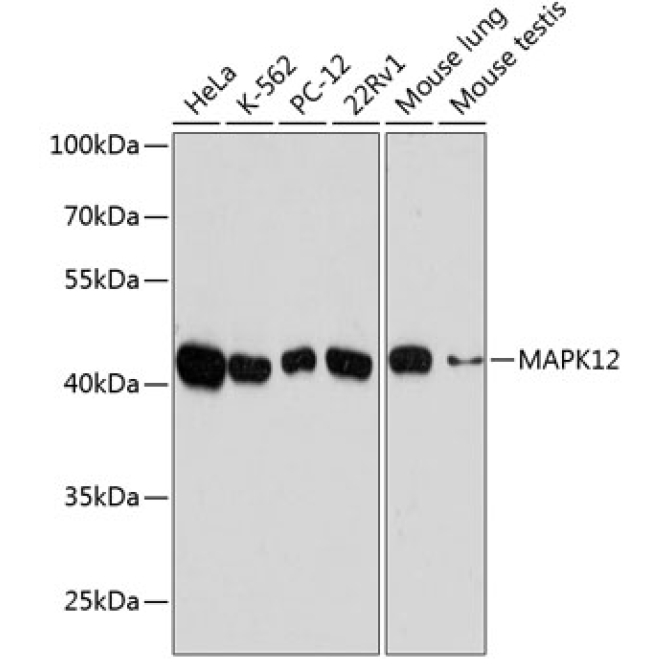 MAPK12 Rabbit Polyclonal Antibody