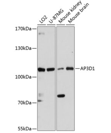 AP3D1 Rabbit Polyclonal Antibody
