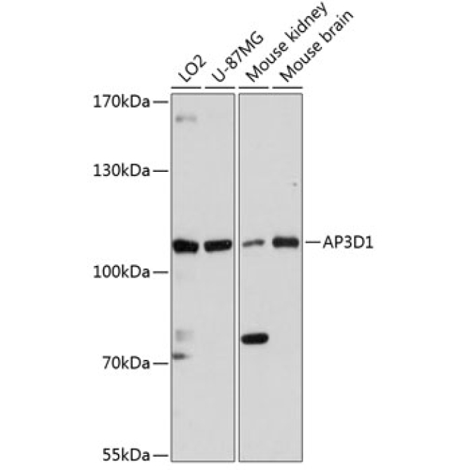 AP3D1 Rabbit Polyclonal Antibody