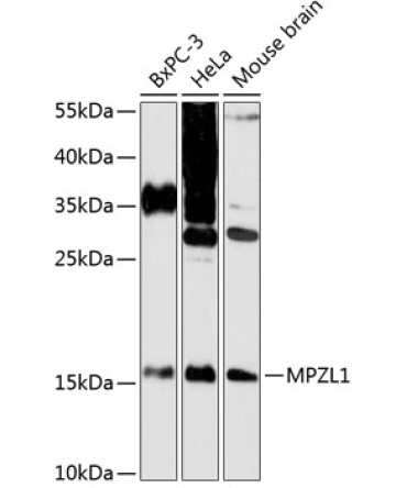 MPZL1 Rabbit Polyclonal Antibody