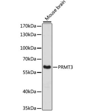 PRMT3 Rabbit Polyclonal Antibody [KO Validated]