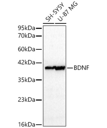 BDNF Rabbit Polyclonal Antibody