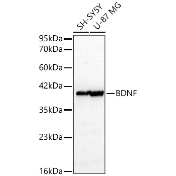 BDNF Rabbit Polyclonal Antibody