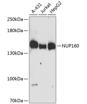 NUP160 Rabbit Polyclonal Antibody