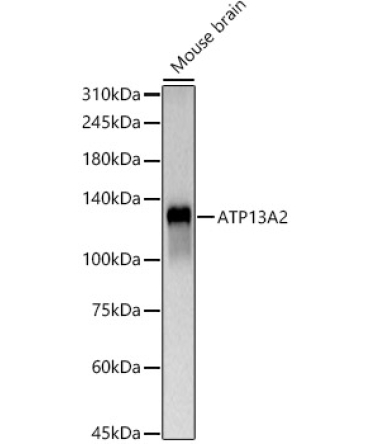 ATP13A2 Rabbit Polyclonal Antibody