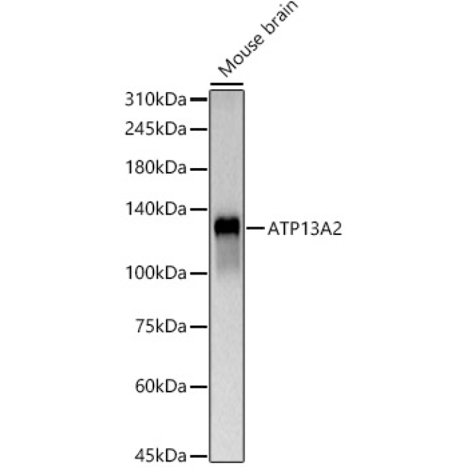 ATP13A2 Rabbit Polyclonal Antibody