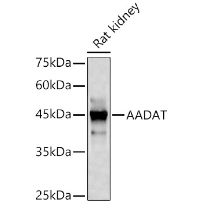 AADAT Rabbit Polyclonal Antibody