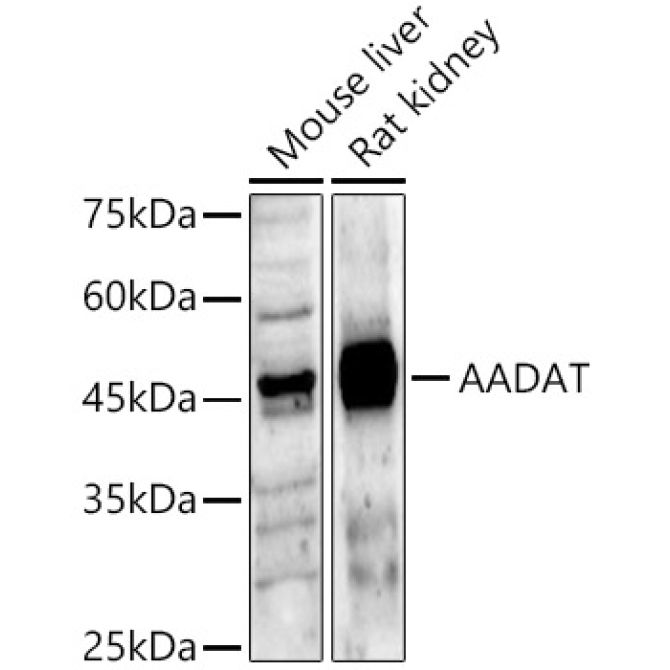 AADAT Rabbit Polyclonal Antibody