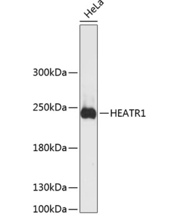HEATR1 Rabbit Polyclonal Antibody