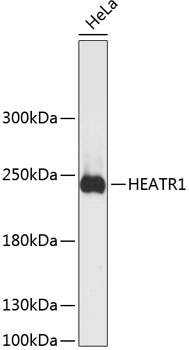 HEATR1 Rabbit Polyclonal Antibody
