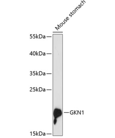 GKN1 Rabbit Polyclonal Antibody
