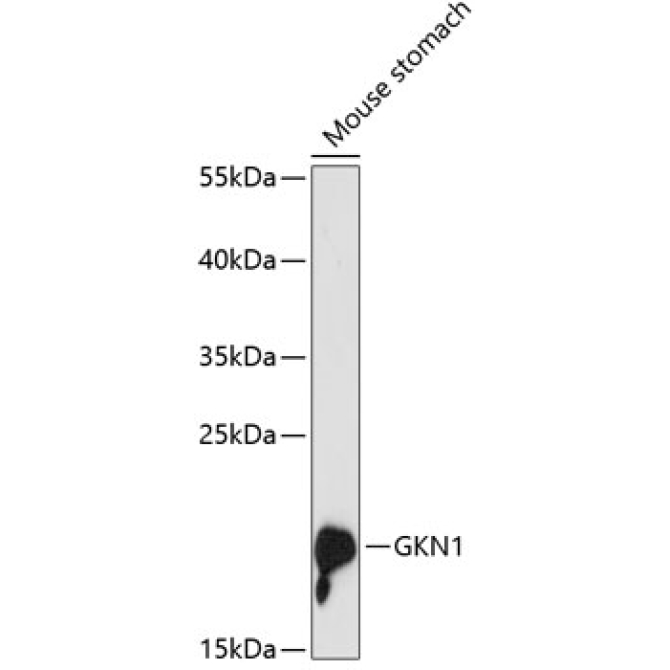 GKN1 Rabbit Polyclonal Antibody