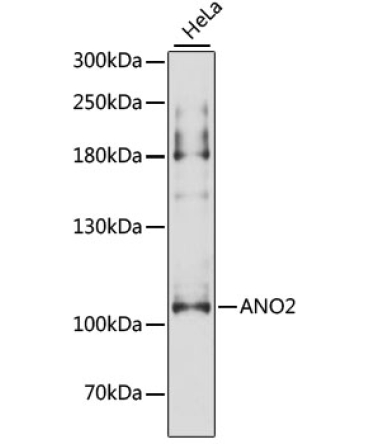 ANO2 Rabbit Polyclonal Antibody