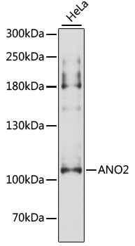 ANO2 Rabbit Polyclonal Antibody