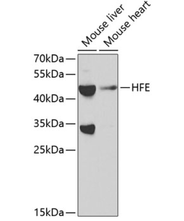 HFE Rabbit Polyclonal Antibody