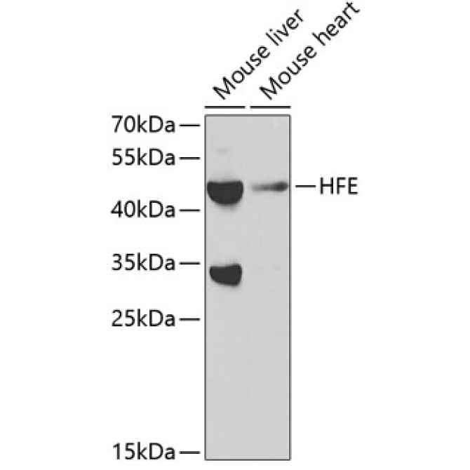 HFE Rabbit Polyclonal Antibody