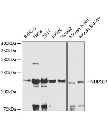 NUP107 Rabbit Polyclonal Antibody