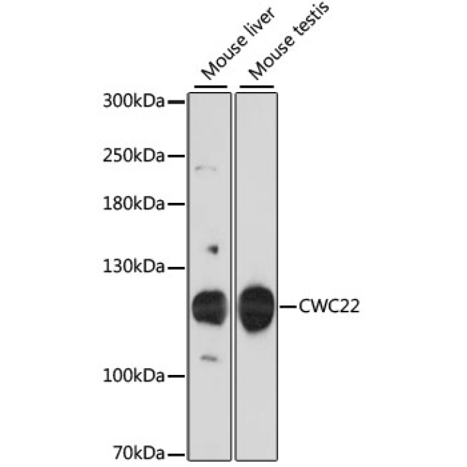 CWC22 Rabbit Polyclonal Antibody