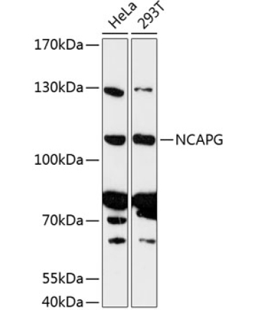NCAPG Rabbit Polyclonal Antibody
