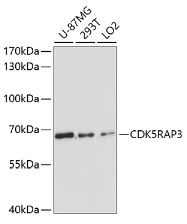 CDK5RAP3 Rabbit Polyclonal Antibody