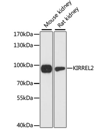 KIRREL2 Rabbit Polyclonal Antibody