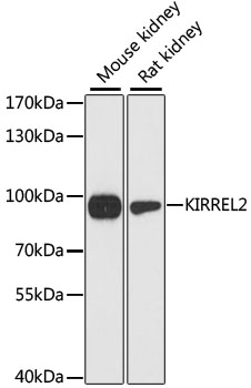 KIRREL2 Rabbit Polyclonal Antibody