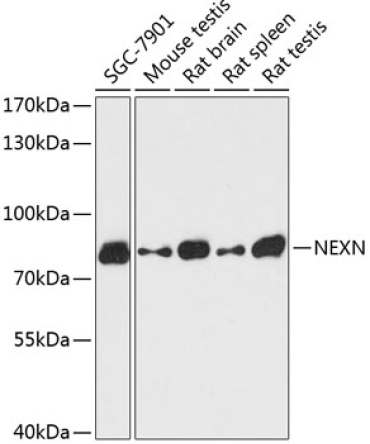 NEXN Rabbit Polyclonal Antibody