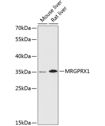 MRGPRX1 Rabbit Polyclonal Antibody