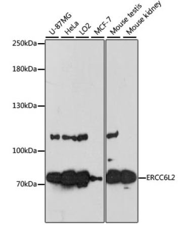 ERCC6L2 Rabbit Polyclonal Antibody