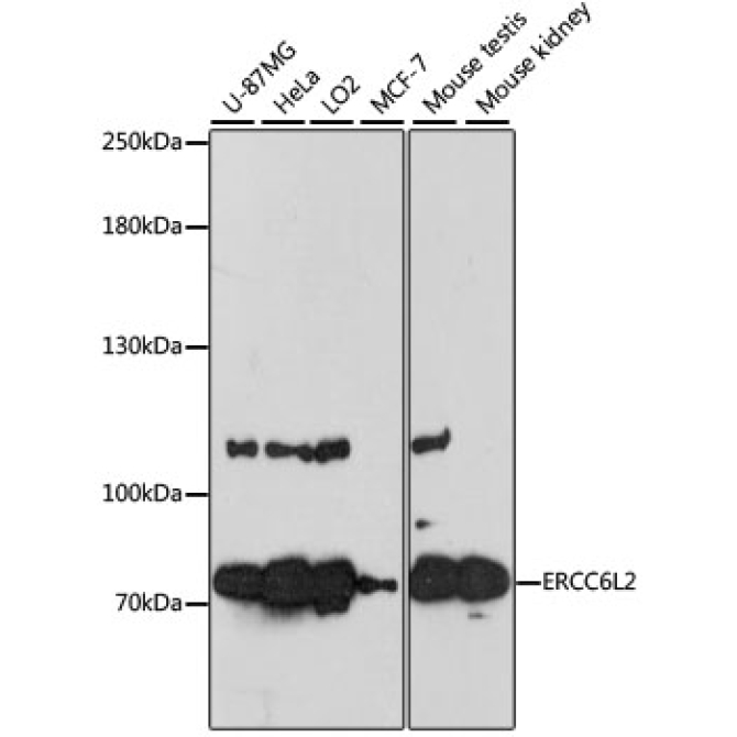 ERCC6L2 Rabbit Polyclonal Antibody