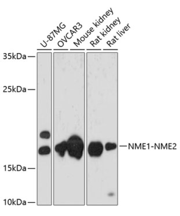 NME1-NME2 Rabbit Polyclonal Antibody