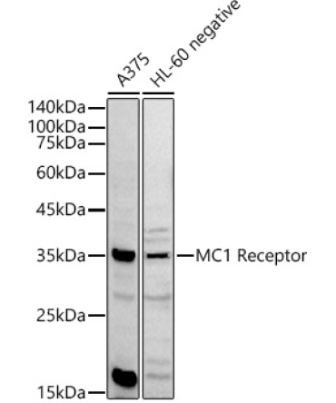 MC1 Receptor Rabbit Polyclonal Antibody