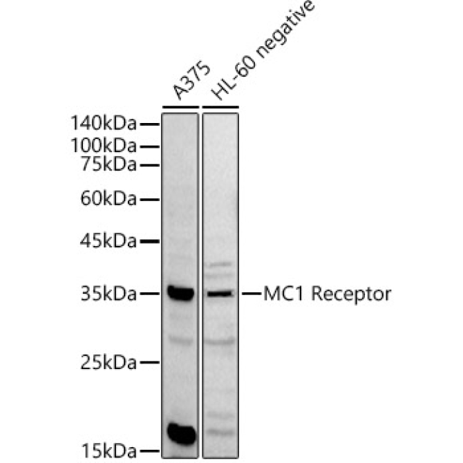MC1 Receptor Rabbit Polyclonal Antibody