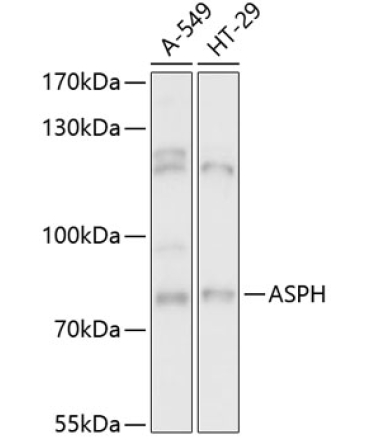 ASPH Rabbit Polyclonal Antibody
