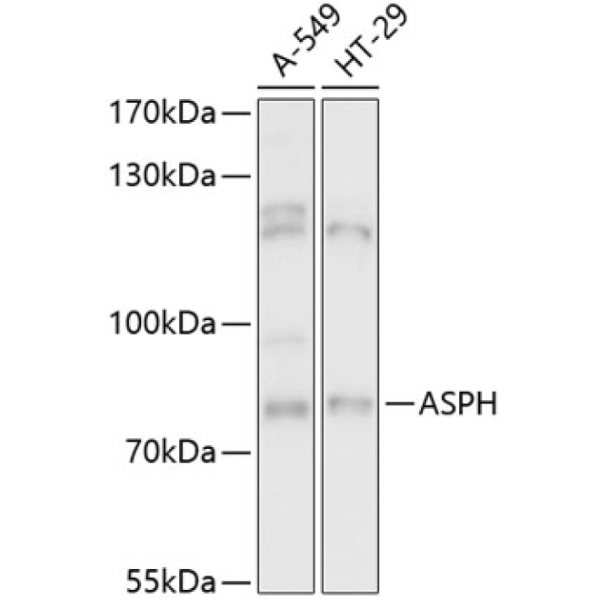 ASPH Rabbit Polyclonal Antibody
