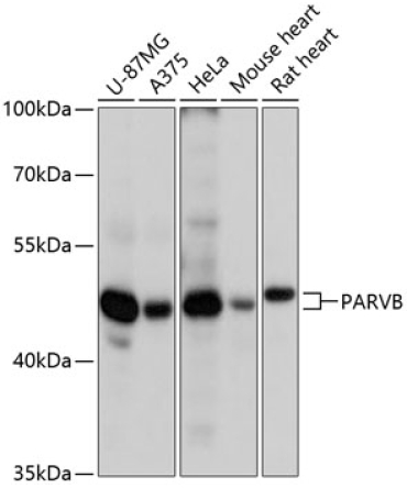 PARVB Rabbit Polyclonal Antibody