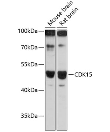CDK15 Rabbit Polyclonal Antibody
