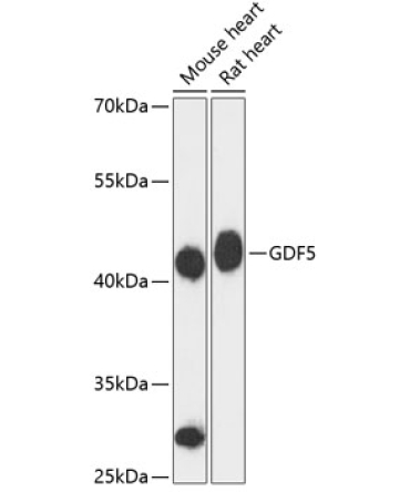 GDF5 Rabbit Polyclonal Antibody