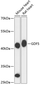 GDF5 Rabbit Polyclonal Antibody