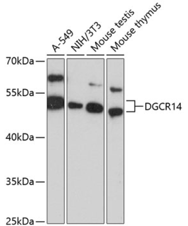 DGCR14 Rabbit Polyclonal Antibody