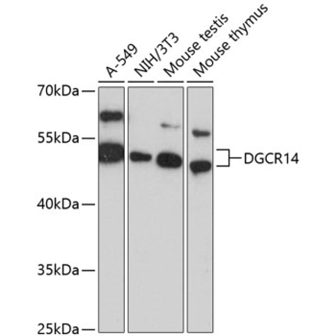 DGCR14 Rabbit Polyclonal Antibody